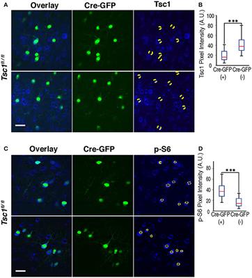 Multiple Critical Periods for Rapamycin Treatment to Correct Structural Defects in Tsc-1-Suppressed Brain